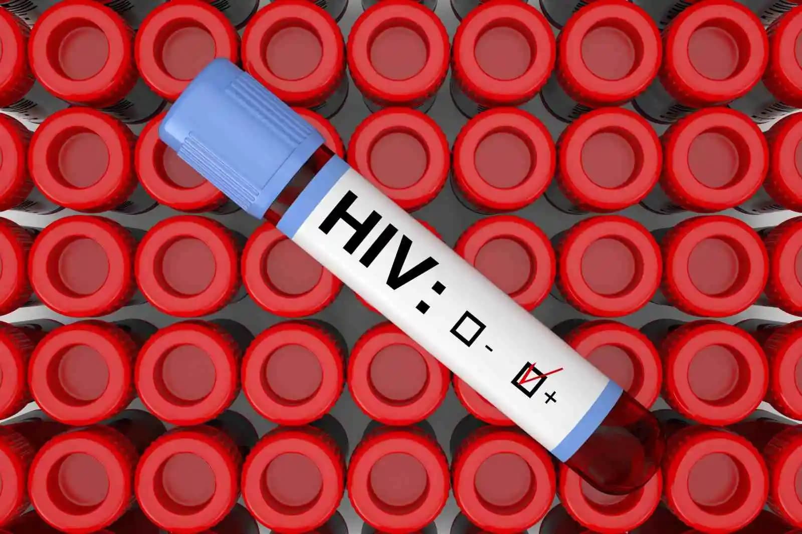 HIV Test in Hindi