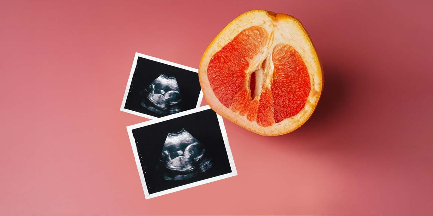 Transvaginal ultrasound scan
