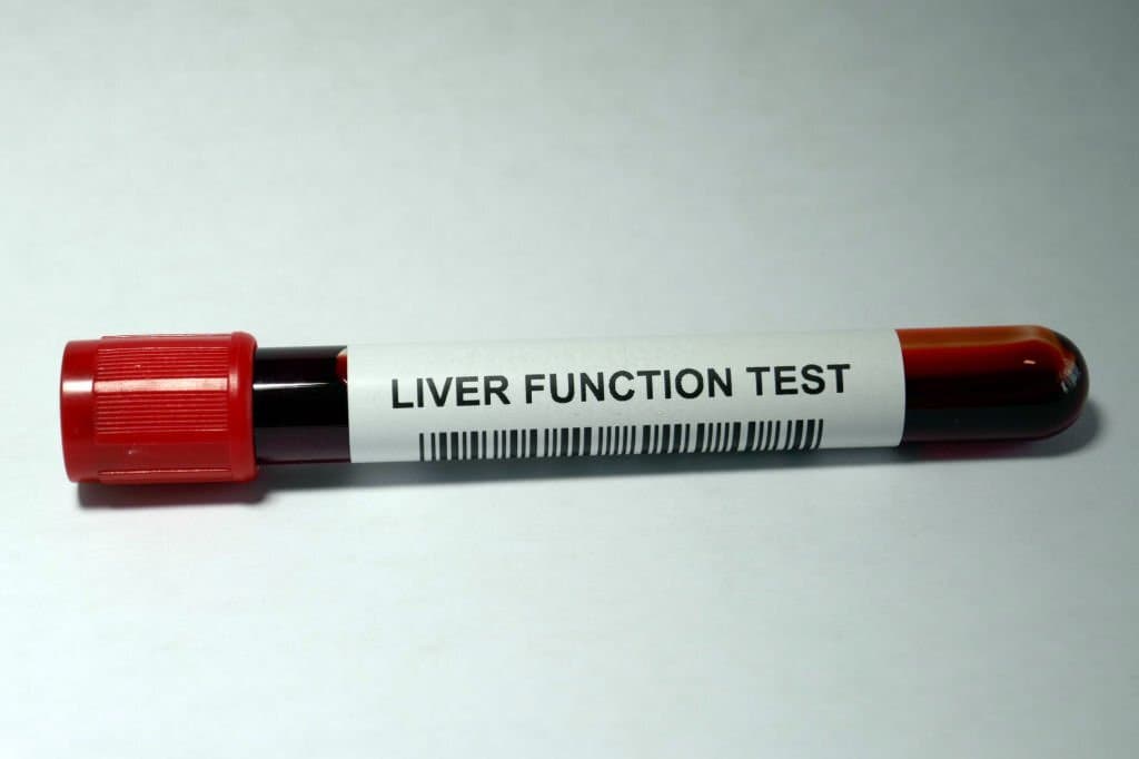 Liver Function Tests normal range