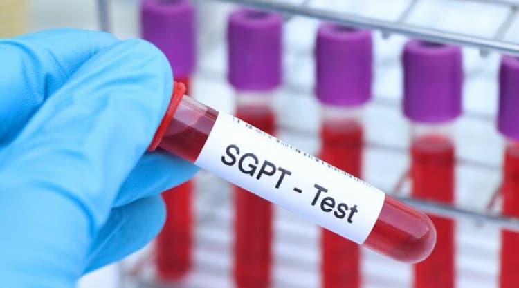 SGPT Test - Normal & High Range, Causes & Symptoms