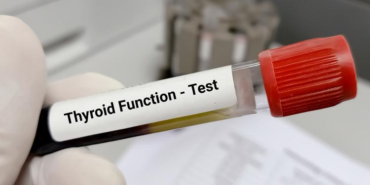 Thyroid Blood Tests - Explained A to Z