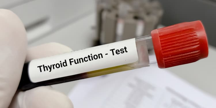 Thyroid Blood Tests - Explained A to Z