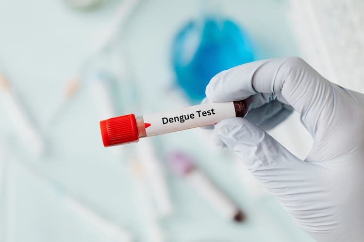 Dengue Test - Price, Procedure, Preparation & Range 2024