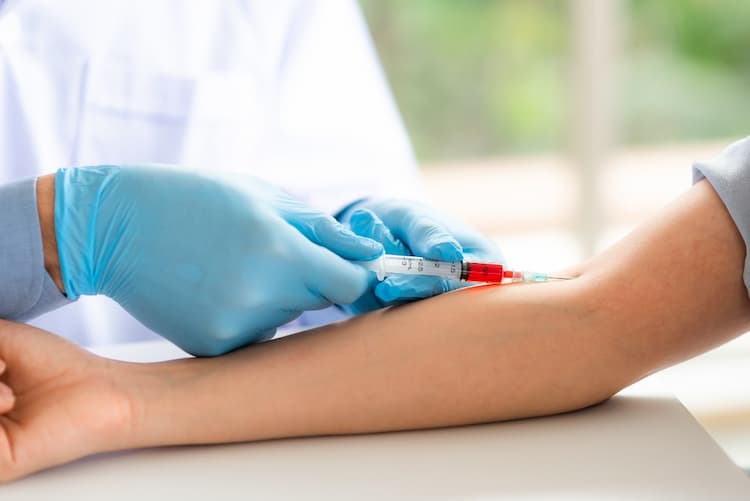 Blood Test For Dengue - Everything You Need To Know