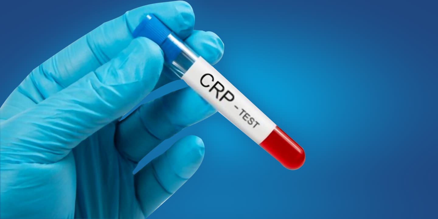 crp test : what is crp test ? How much crp level is dangerous ?