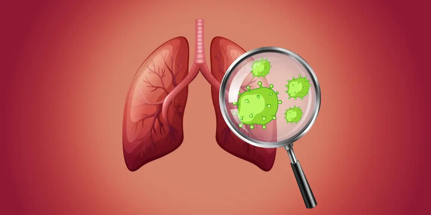 Lung cancer Prevention, Symptoms and treatment