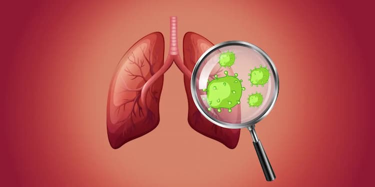 Lung cancer: prevention, symptoms, and treatment
