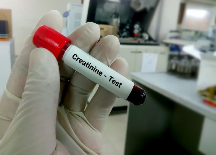 What Is Creatinine Test Normal Range? Everything You Need To Know
