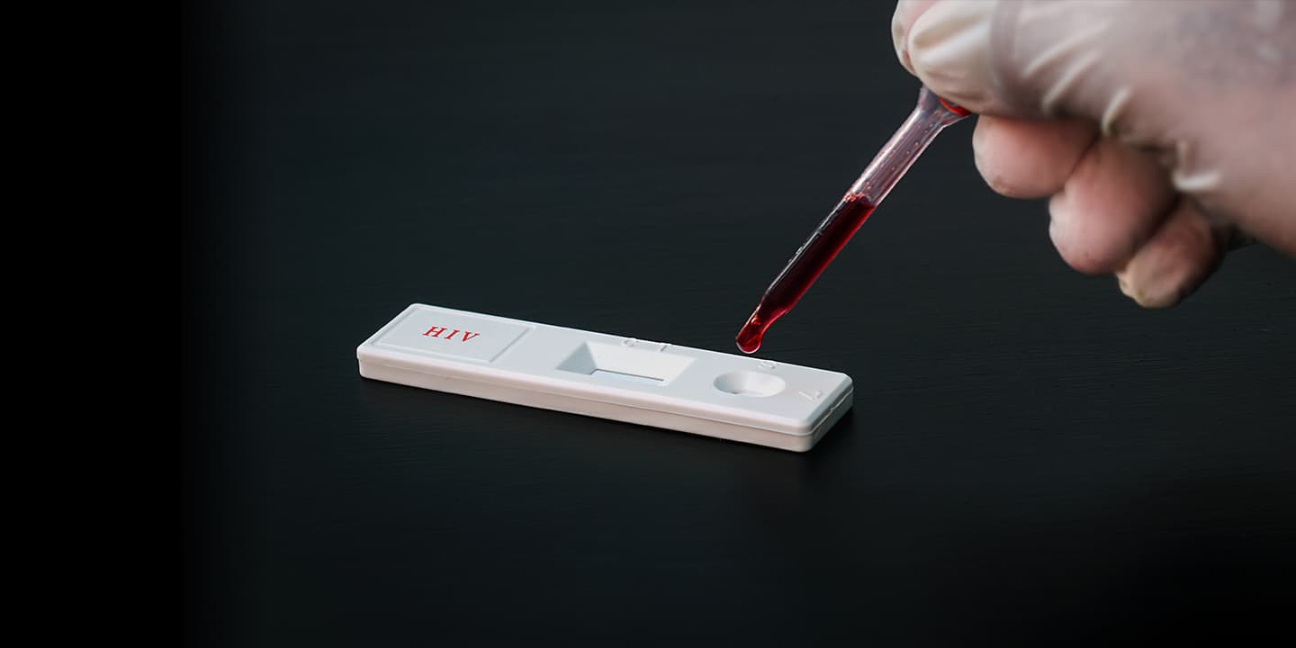 hiv-test-kit
