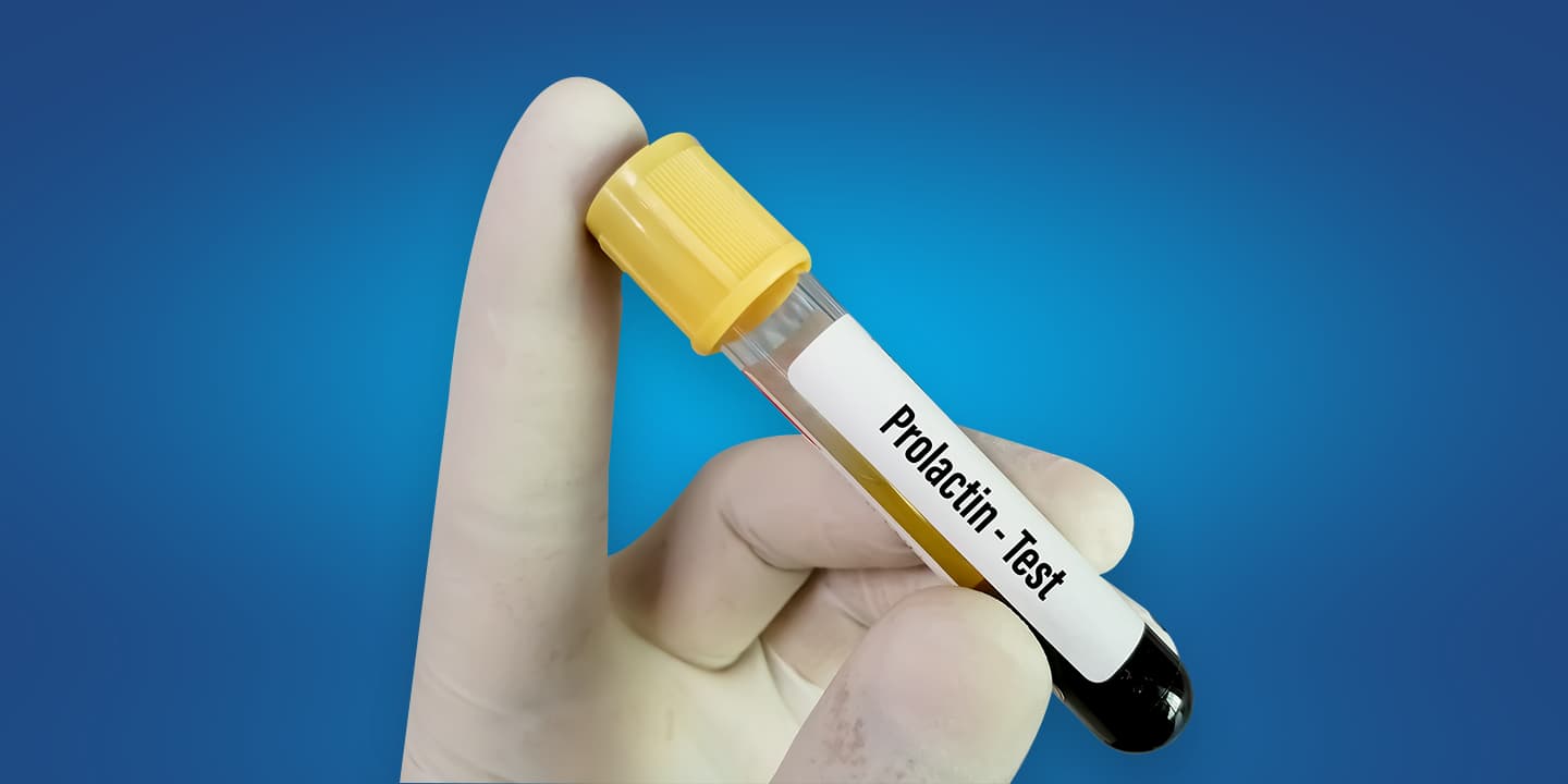 Prolactin Test: High vs Low Levels, Normal Range, Cost in India, and More