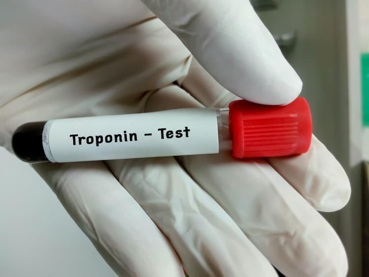 Troponin I Test in Hindi: हृदय रोगों की पहचान: ट्रोपोनिन आई परीक्षण
