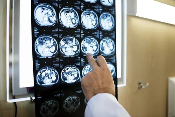CT Scan Vs MRI Scan: Choosing the right scan, uses and difference