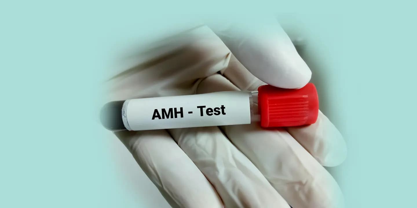 AMH Test What is It, Full Form, Why is It Done, Cost in India, Normal Range and More