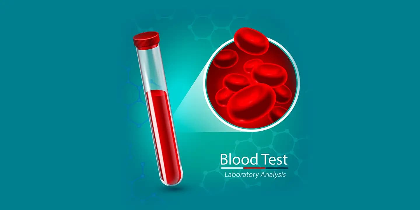Blood Tests for Heart Disease Lipid Profile Test, hs CRP Test, and More that Detect Heart Disease, Price in India