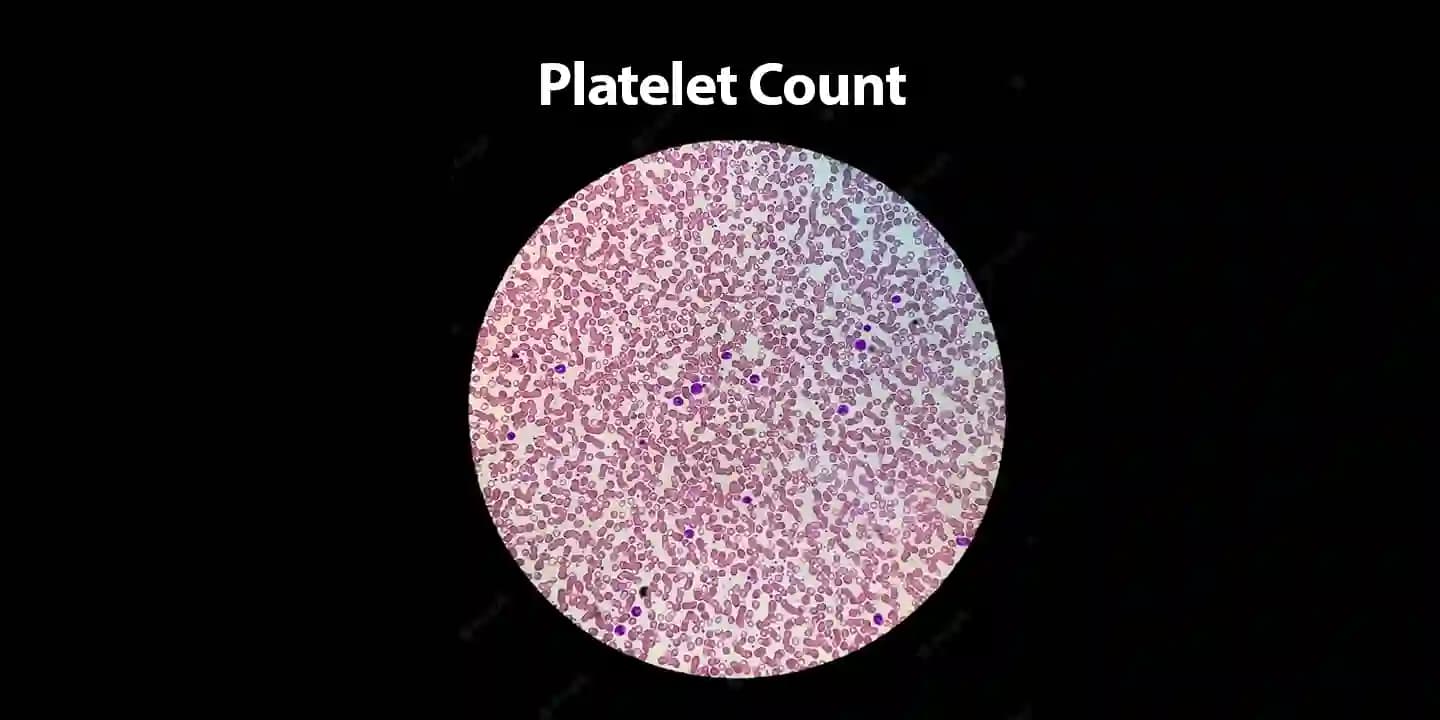 Platelet Count Increase Foods How to Increase Blood Platelets Naturally