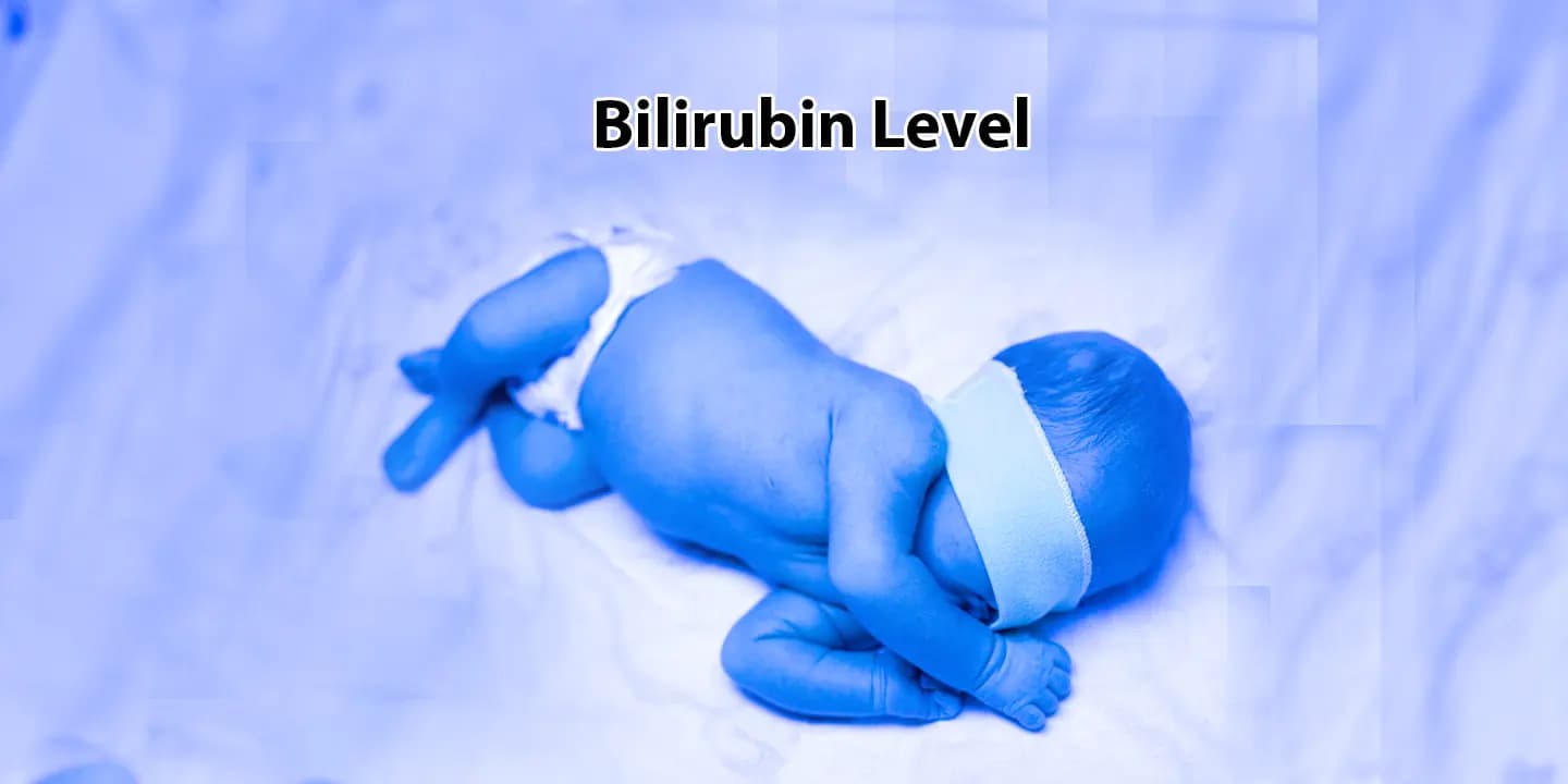 Bilirubin Level in Newborn Baby Normal Range Values, Physiological Jaundice vs Pathological Jaundice