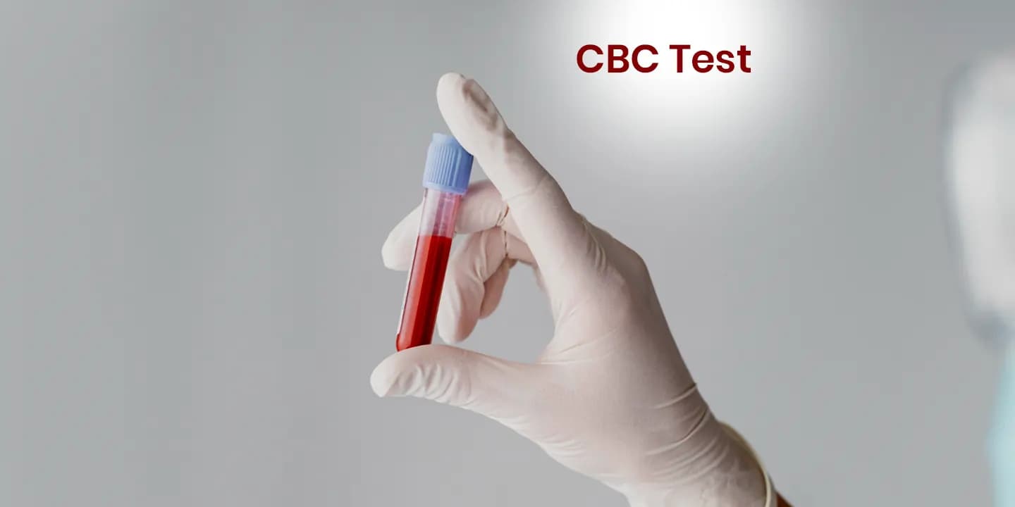 CBC Test What is the Normal Range, What Do Abnormal Levels Indicate