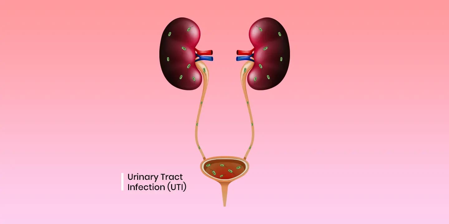 Urinary Tract Infection (UTI) Symptoms , Causes and Treatment