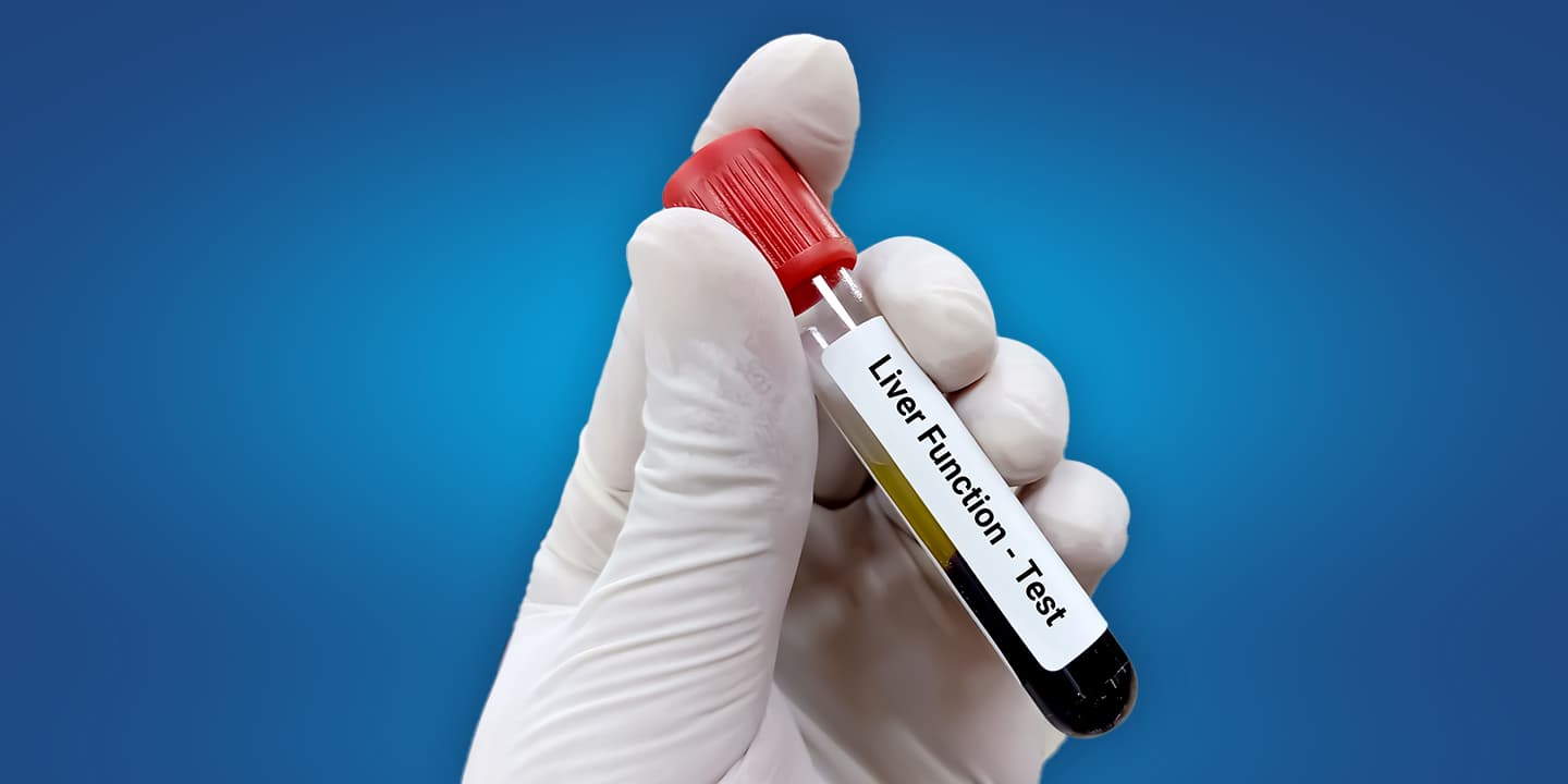 SGPT-Liver-Blood-Tests-Normal-High-Range
