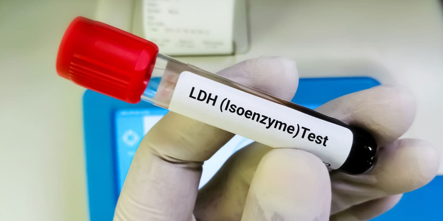 LDH-Test