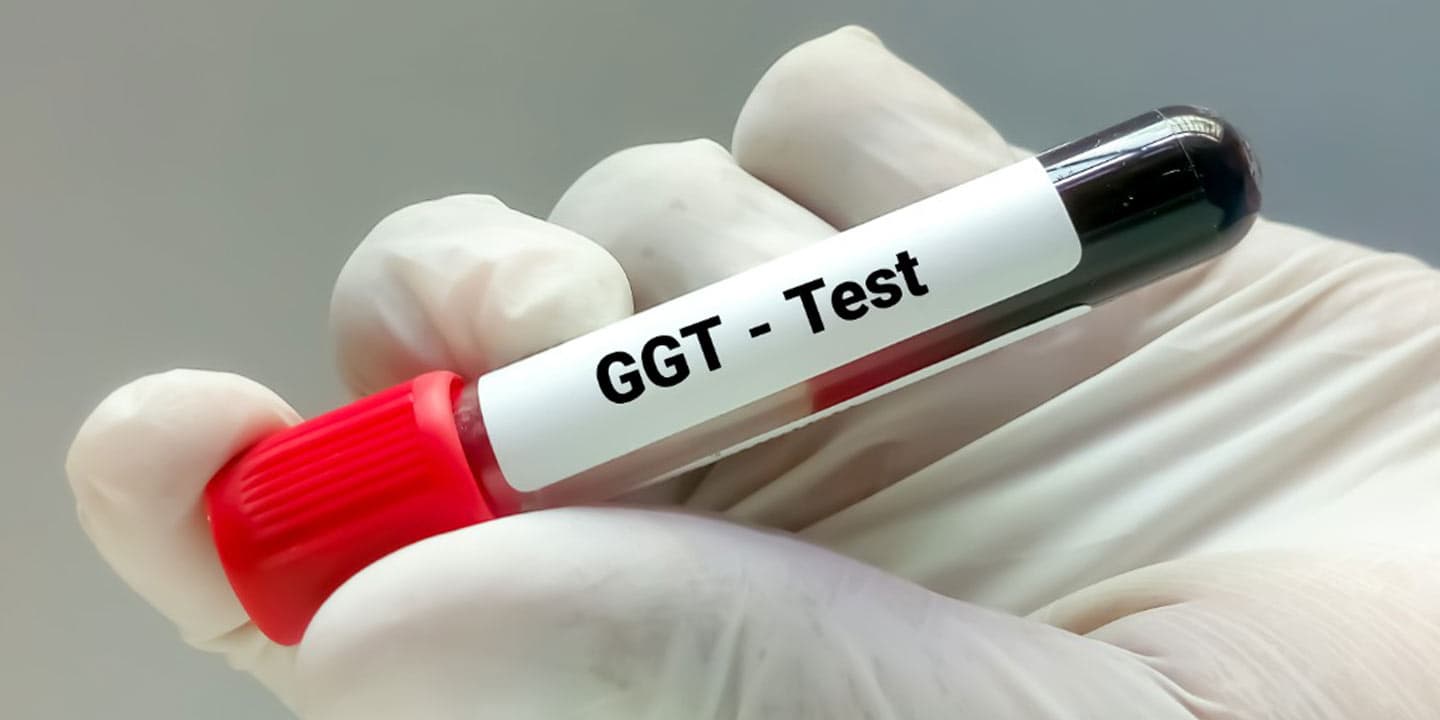 Gamma-glutamyl-Transferase-(GGT)-Test