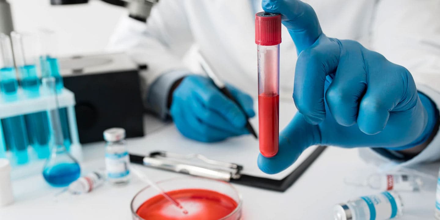 mced test can detect cancer in blood