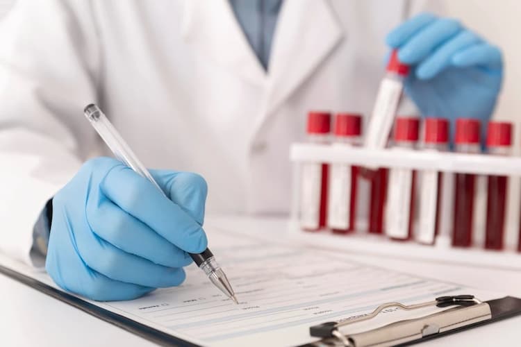 सीबीसी ब्लड टेस्ट ( CBC blood test) कब करना चाहिए?