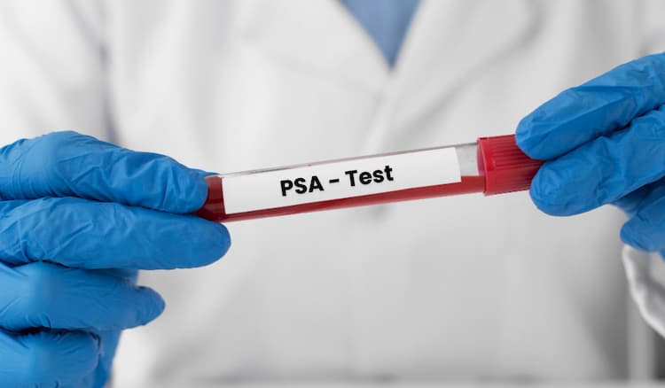 PSA Test in Hindi - क्या है, इसका खर्च, लक्षण, और कैसे होता है?