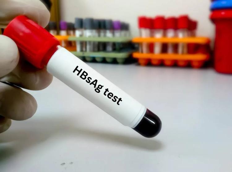 Hbsag Test in Hindi: क्यों, कैसे किया जाता है, इसके लाभ, जाने