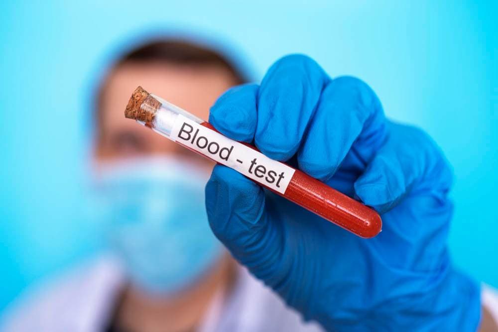 LH Blood Test