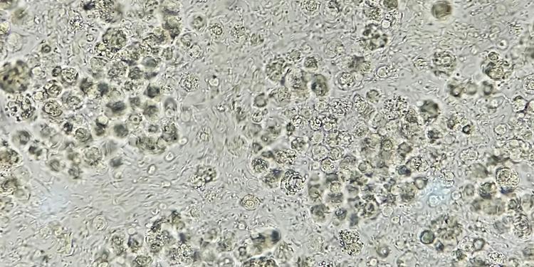 প্রস্রাবেপুঁজকোষওতারস্বাভাবিকপরিসীমা