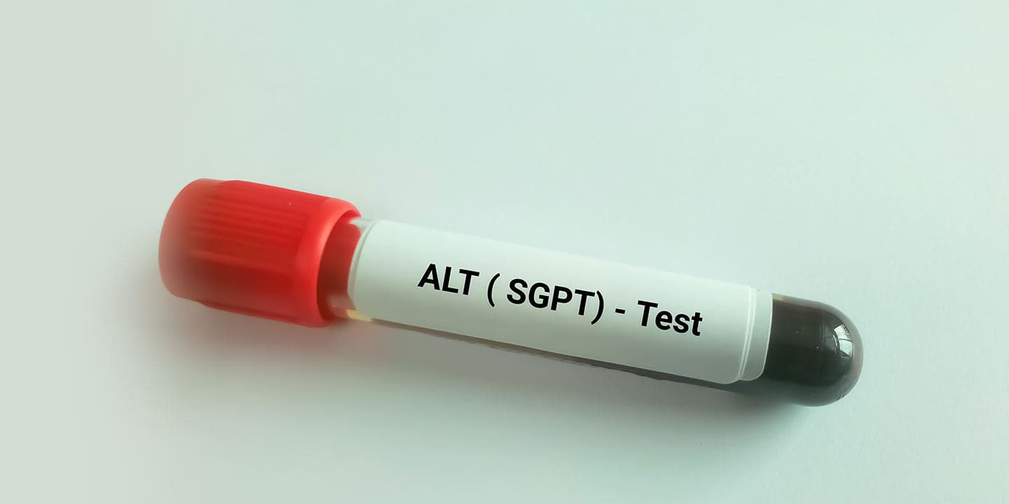 SGPT liver blood test and its range, causes and symptoms in bengali
