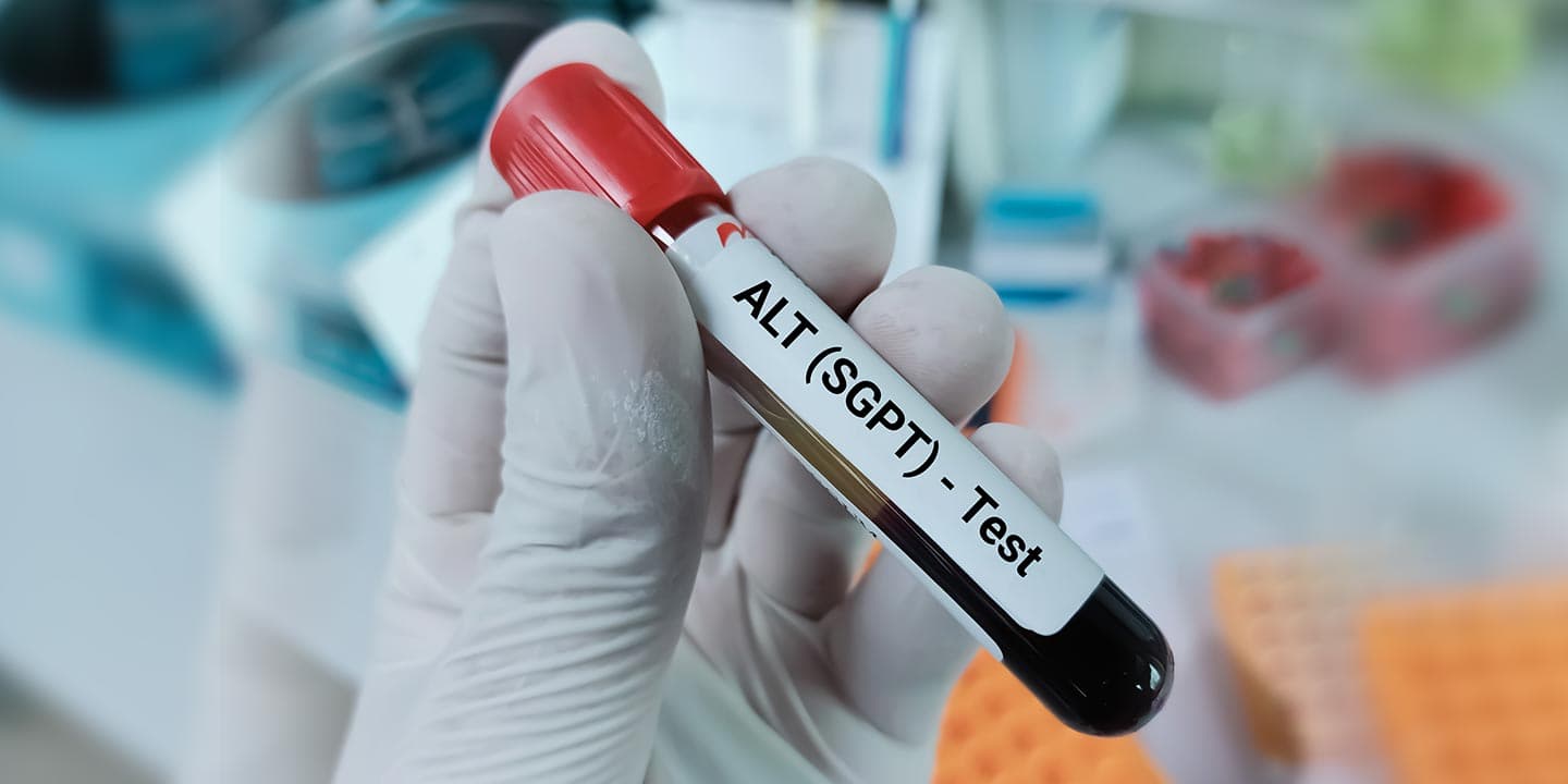 SGPT-Liver-Blood-Tests