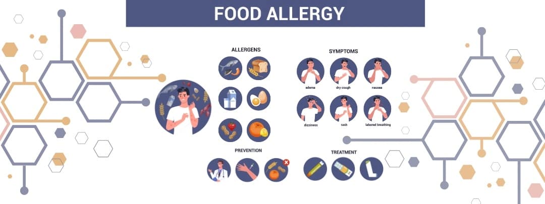 Food Allergy Symptoms, Diagnosis & Treatment