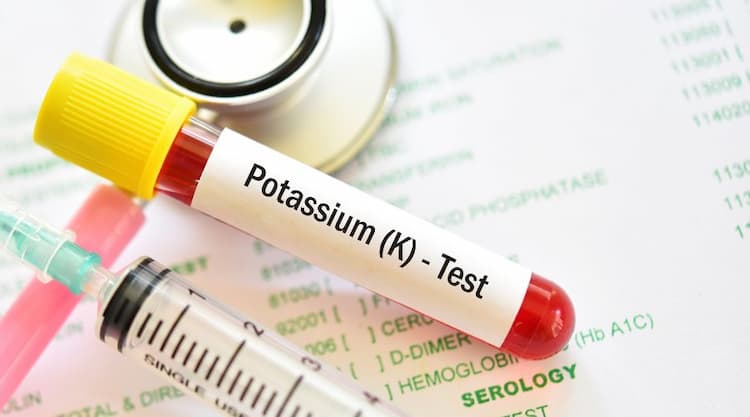 Potassium Test in Hindi: स्वास्थ्य जाँच में पोटैशियम स्तर की जांच करें
