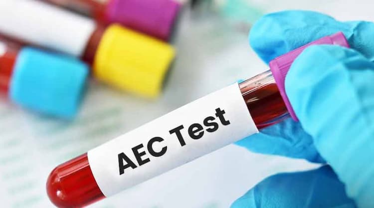 AEC Test in Hindi – क्या है, किसको, और क्यों करना चाहिए