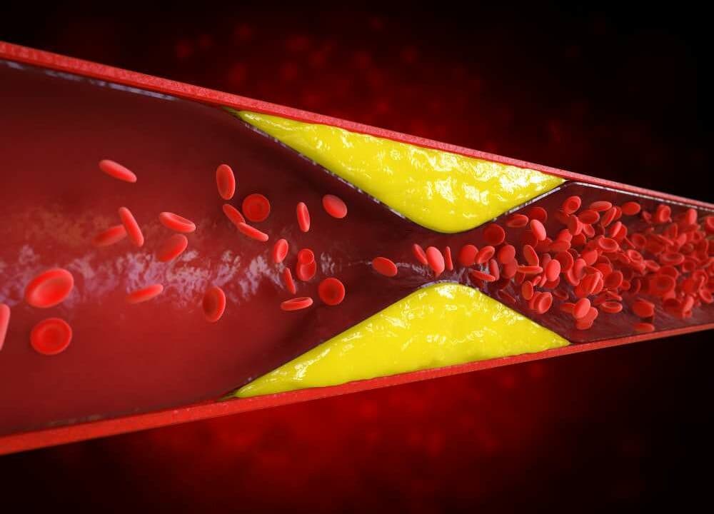 HDL Cholesterol in Hindi