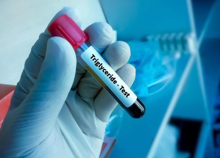 Triglycerides Meaning in Hindi - ट्राइग्लिसराइड्स बढ़ने के कारण, लक्षण तथा उपचार