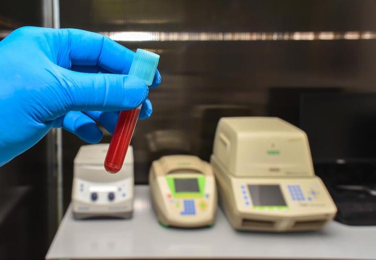 CEA Test in Hindi – कैंसर की स्क्रीनिंग में एक प्रमुख रोल