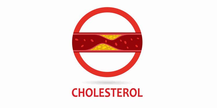 Cholesterol in Hindi - इसके प्रकार, कारण, लक्षण, तथा उपाय