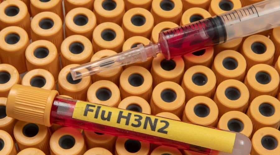 H3N2 Symptoms