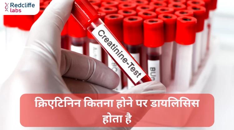 क्रिएटिनिन कितना होने पर डायलिसिस होता है?