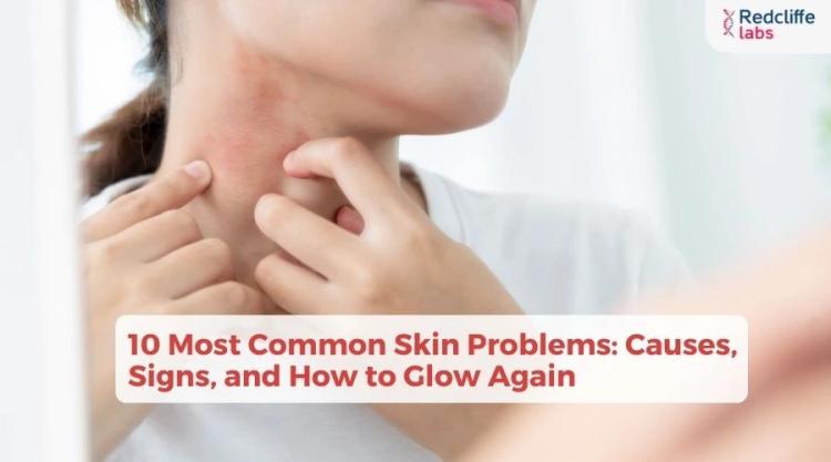 10 Most Common Skin Problems: Causes, Signs, and How to Glow Again