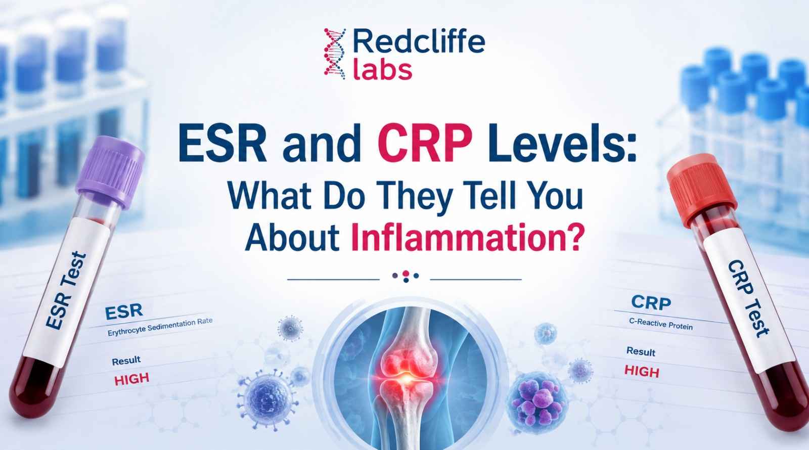 https://myhealth-redcliffelabs.redcliffelabs.com/media/blogcard-images/5862/eb5723dc-833e-48ec-afca-05b23f3191a5.jpeg