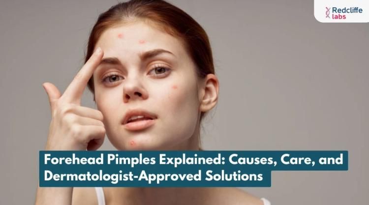 Forehead Pimples Explained: Causes, Care, and Dermatologist-Approved Solutions