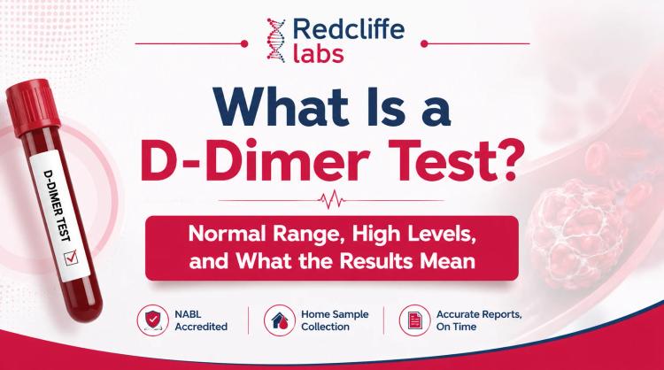 What Is a D-Dimer Test? Normal Range, High Levels, and What the Results Mean