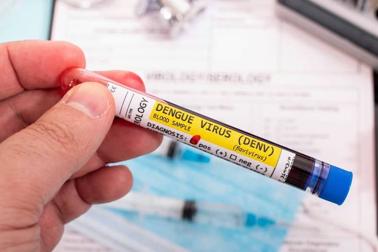 Dengue Test: How to Read Dengue Report