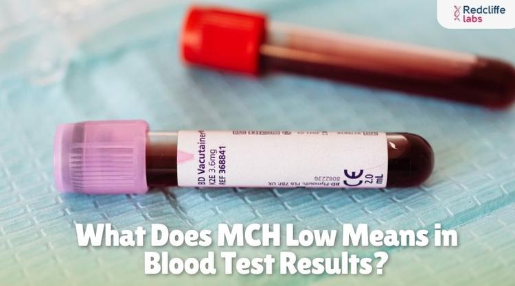 What Does MCH Low Means in Blood Test Results?