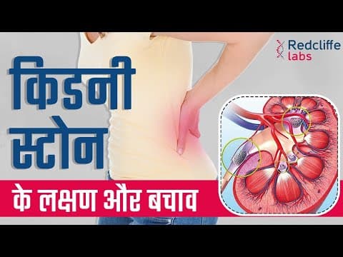 किडनी स्टोन के लक्षण और बचाव | Kidney Stone Early Symptoms And Prevention in Hindi