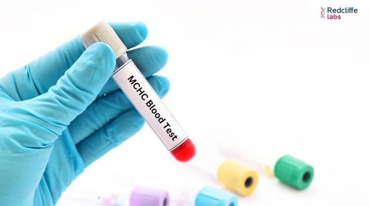 MCHC Blood Test in Hindi: इसके फायदे क्यों और कब करना चाहिए